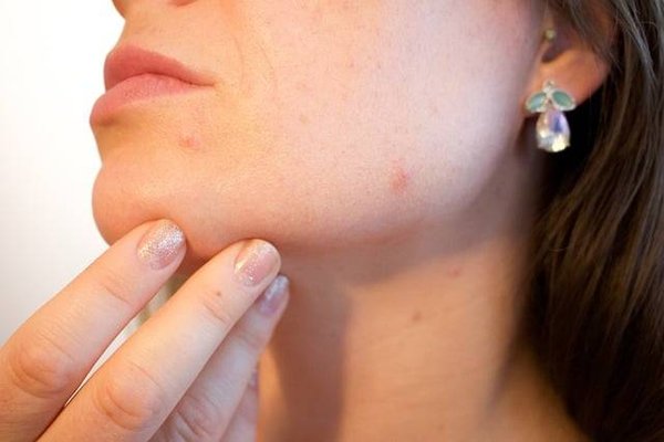 Comment protéger sa peau en hiver ?